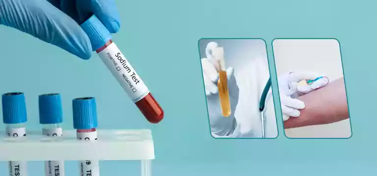 Sodium Test: What Is It, Uses, Preparation, Procedure, Cost & Diagnostic Lab Near You
